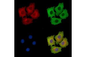 ABIN7095914 and ABIN7099976 staining HepG2 cells by IF/ICC. (CCSER1 抗体)