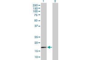 Western Blot analysis of SAP18 expression in transfected 293T cell line by SAP18 MaxPab polyclonal antibody. (SAP18 抗体  (AA 1-153))