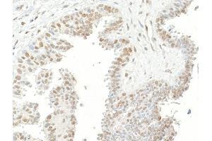 Immunohistochemistry (IHC) image for anti-Ubiquitin Specific Peptidase 7 (Herpes Virus-Associated) (USP7) (AA 1-50) antibody (ABIN7453547) (USP7 抗体  (AA 1-50))