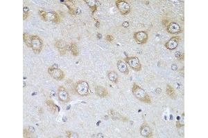 Immunohistochemistry of paraffin-embedded Mouse brain using TMOD3 Polyclonal Antibody at dilution of 1:100 (40x lens). (TMOD3 抗体)