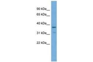 Image no. 1 for anti-Protein Tob1 (TOB1) (AA 215-264) antibody (ABIN6745657) (Protein Tob1 (TOB1) (AA 215-264) 抗体)