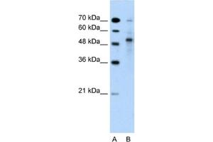 Western Blotting (WB) image for anti-Tripartite Motif Containing 59 (TRIM59) antibody (ABIN2462701)