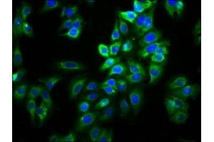 Immunofluorescence staining of HepG2 cells with ABIN7170215 at 1:66, counter-stained with DAPI. (Slc26a9 抗体  (AA 551-660))