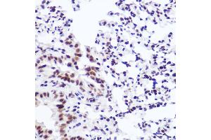 Immunohistochemistry of paraffin-embedded mouse lung using USP39 Rabbit mAb (ABIN7271160) at dilution of 1:100 (40x lens). (USP39 抗体)