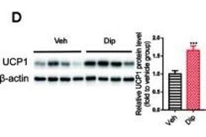 Diphyllin enhances brown/beige thermogenesis and reduces adipocyte size in DIO mice. (UCP1 抗体  (AA 1-307))