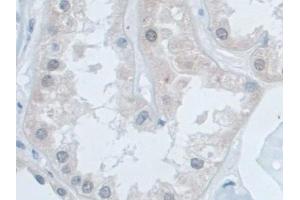 Immunohistochemistry (IHC) image for anti-Small Nuclear Ribonucleoprotein D1 Polypeptide 16kDa (SNRPD1) (AA 1-119) antibody (ABIN7442903)