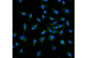 IF analysis of Neuropilin 1 using anti-Neuropilin 1 antibody (ABIN7601920). (Neuropilin 1 抗体  (AA 504-827))