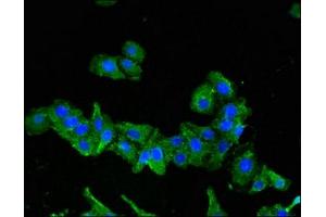 Immunofluorescence (IF) image for anti-Sema Domain, Transmembrane Domain (TM), and Cytoplasmic Domain, (Semaphorin) 6A (SEMA6A) (AA 755-990) antibody (ABIN7168819)