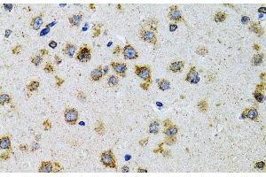 Immunohistochemistry of paraffin-embedded Rat brain using PDYN Polyclonal Antibody at dilution of 1:100 (40x lens). (PDYN 抗体)
