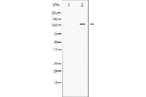 Western blot analysis of NF- kappaB p105/p50 phosphorylation expression in LPS treated HeLa whole cell lysates,The lane on the left is treated with the antigen-specific peptide.