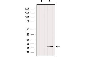 Western Blotting (WB) image for anti-Single-Stranded DNA Binding Protein 1 (SSBP1) (Internal Region) antibody (ABIN6259198)
