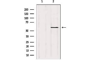 Western blot analysis of extracts from rat heart, using Cytochrome P450 3A4 Antibody. (CYP3A4 抗体)