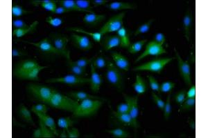 Immunofluorescence staining of U251 cells with ABIN7162583 at 1:266, counter-stained with DAPI. (PANX1 抗体  (AA 288-426))