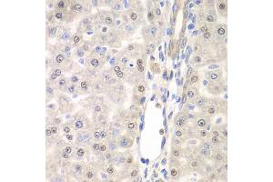 Immunohistochemistry of paraffin-embedded rat liver using DTX2 antibody (ABIN6127799, ABIN6139853, ABIN6139854 and ABIN6223266) at dilution of 1:100 (40x lens). (DTX2 抗体  (AA 1-280))