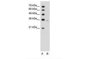 Image no. 1 for anti-phosphoribosyl Pyrophosphate Synthetase 2 (PRPS2) (AA 157-206) antibody (ABIN203392) (PRPS2 抗体  (AA 157-206))