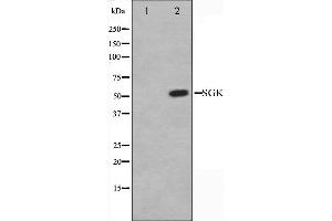 Western blot analysis of SGK expression in Jurkat whole cell lysates,The lane on the left is treated with the antigen-specific peptide. (SGK1 抗体  (C-Term))