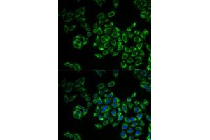 Immunofluorescence analysis of MCF-7 cells using FIS1 antibody.