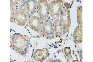 Immunohistochemistry of paraffin-embedded Human stomach using MRPS22 Polyclonal Antibody at dilution of 1:100 (40x lens). (MRPS22 抗体)