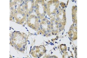 Immunohistochemistry of paraffin-embedded Human stomach using MRPS22 Polyclonal Antibody at dilution of 1:100 (40x lens).