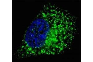 Fluorescent image of Chloroquine treated U251 cells stained with GABARAP antibody.