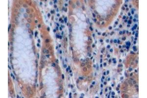 Detection of CD7 in Human Stomach Tissue using Polyclonal Antibody to Cluster Of Differentiation 7 (CD7)