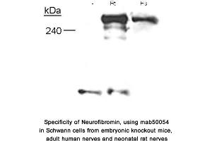 Image no. 1 for anti-Neurofibromin 1 (NF1) (N-Term) antibody (ABIN363208) (Neurofibromin 1 抗体  (N-Term))
