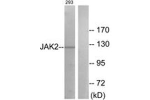 Western blot analysis of extracts from 293 cells, treated with etoposide 25uM 24h, using JAK2 (Ab-570) Antibody.