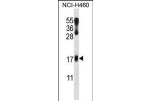 LMO2 Antibody (N-term) (ABIN658023 and ABIN2846961) western blot analysis in NCI- cell line lysates (35 μg/lane). (LMO2 抗体  (N-Term))