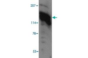 Western blot analysis of AMBRA1 in human heart tissue lysate with AMBRA1 polyclonal antibody  at (A) 0. (AMBRA1 抗体  (C-Term))