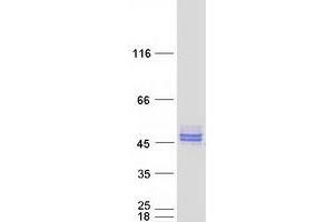 Western Blotting (WB) image for Nudix (Nucleoside Diphosphate Linked Moiety X)-Type Motif 9 (NUDT9) (Transcript Variant 3) protein (Myc-DYKDDDDK Tag) (ABIN2727779)