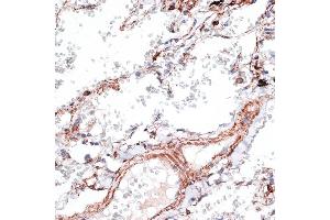 Immunohistochemistry (IHC) image for anti-Vimentin (VIM) (AA 1-200) antibody (ABIN3016292)