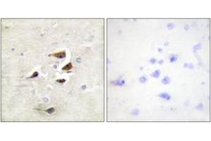 Immunohistochemistry analysis of paraffin-embedded human brain tissue, using CaMK2 alpha/beta/delta (Ab-305) Antibody. (CaMK2 alpha/beta/delta 抗体  (AA 271-320))