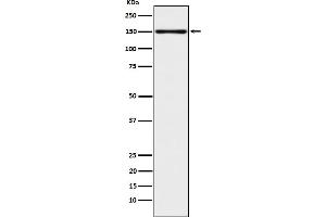 Western blot analysis of CLSTN1 expression in 293T cell lysate. (Recombinant Calsyntenin 1 抗体)