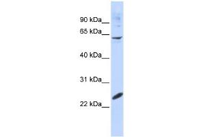 WB Suggested Anti-SMAD4 Antibody Titration:  0. (SMAD4 抗体  (N-Term))