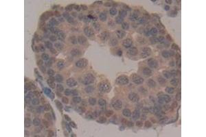 Used in DAB staining on fromalin fixed paraffin- embedded Kidney tissue (TPSB2 抗体  (AA 30-274))