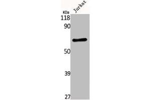Western Blot analysis of Jurkat cells using Kv3. (Kv3.4 抗体)