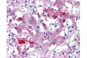 Anti-USP20 antibody IHC of human adrenal medulla. (USP20 抗体  (Internal Region))