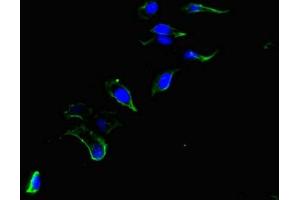 Immunofluorescent analysis of Hela cells using ABIN7147399 at dilution of 1:100 and Alexa Fluor 488-congugated AffiniPure Goat Anti-Rabbit IgG(H+L) (CEP192 抗体  (AA 447-711))