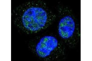 Immunofluorescence (IF) image for anti-Retinoblastoma 1 (RB1) (pSer811) antibody (ABIN3001786)