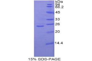 SDS-PAGE analysis of Rat GCLC Protein. (GCLC 蛋白)