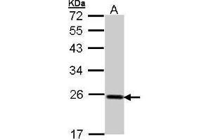 Glutathione Peroxidase 2 抗体  (C-Term)