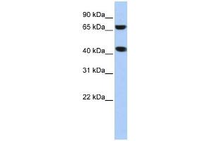 ELAC1 antibody used at 1 ug/ml to detect target protein. (ELAC1 抗体)