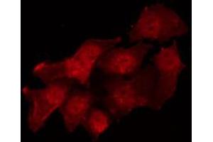 Immunofluorescence (fixed cells) (IF/ICC) image for anti-Proto-oncogene tyrosine-protein kinase Src (Src) (pTyr530) antibody (ABIN6256758)