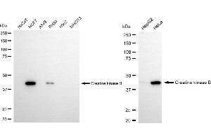 Western blotting analysis using creatine kinase B antibody (ABIN7798161). (Recombinant CKB 抗体)
