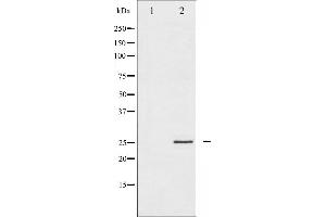 Western blot analysis of eIF4E expression in FBS treated NIH-3T3 whole cell lysates,The lane on the left is treated with the antigen-specific peptide. (EIF4E 抗体  (C-Term))