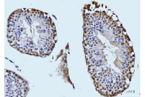 IHC analysis of SBNO1 using anti-SBNO1 antibody (ABIN7601710). (SBNO1 抗体  (AA 43-1303))
