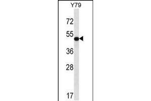 Western blot analysis in Y79 cell line lysates (35ug/lane). (HOXA13 抗体  (C-Term))