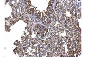 IHC-P Image AICDA antibody [N1N2], N-term detects AICDA protein at cytosol on mouse lymph node by immunohistochemical analysis. (AICDA 抗体  (N-Term))