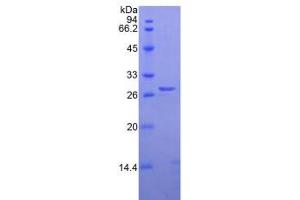 SDS-PAGE analysis of Human Elastase 3B Protein. (Elastase 3B 蛋白)