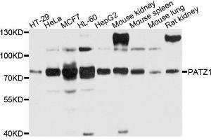 Western blot analysis of extracts of various cells, using PATZ1 antibody. (PATZ1 抗体)